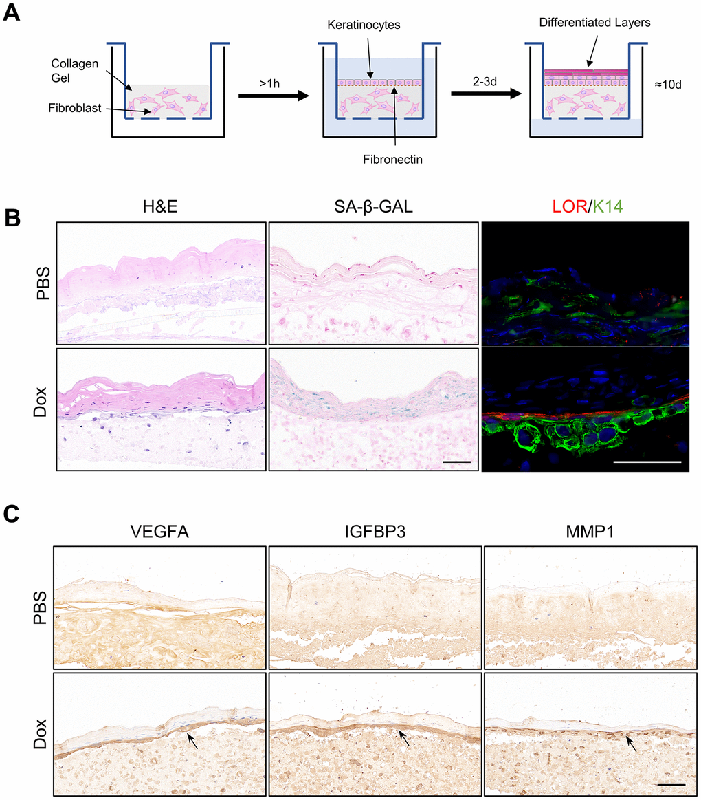 Organotypic 3D skin model constructed with reversibly immortalized NHEK showed aging phenotypes with Dox induction. (A) Flowchart of organotypic skin culture. (B) H&E staining, SA-β-GAL staining, and immunofluorescent staining of Loricrin and K14 in organotypic skin cultures constructed with reversibly immortalized keratinocytes with PBS or Dox treatment. Scale bar = 20 μm. (C) IHC staining analysis of SASP-related proteins VEGFA, IGFBP3 and MMP1 in organotypic 3D skin cultures constructed with reversibly immortalized keratinocytes with either PBS or Dox treatment. Scale bar = 20 μm.