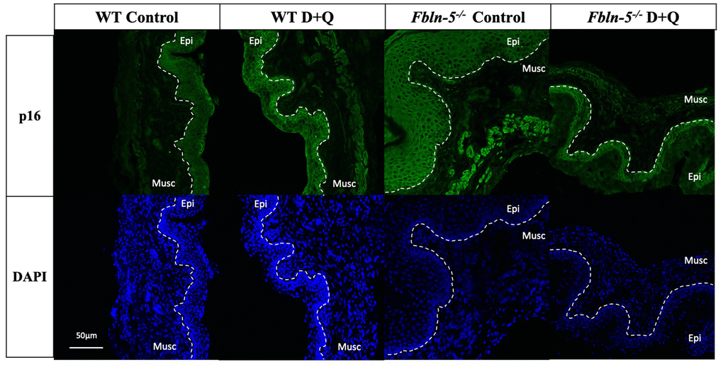 Impact of serial dasatinib and quercetin (D+Q) injections on p16 expression in the vaginal tissue of wild type (WT) and Fibulin-5 knockout (Fbln-5-/-) mice at 20 weeks of life. Representative tissue sections from WT control, WT treatment, Fbln-5-/- control and Fbln-5-/- treatment mice. Top panels demonstrate differences in p16 expression between groups. Bottom panels display corresponding DAPI staining to label cellular nuclei for anatomical reference. Epi=epithelium, Musc=muscularis. 20x magnification.