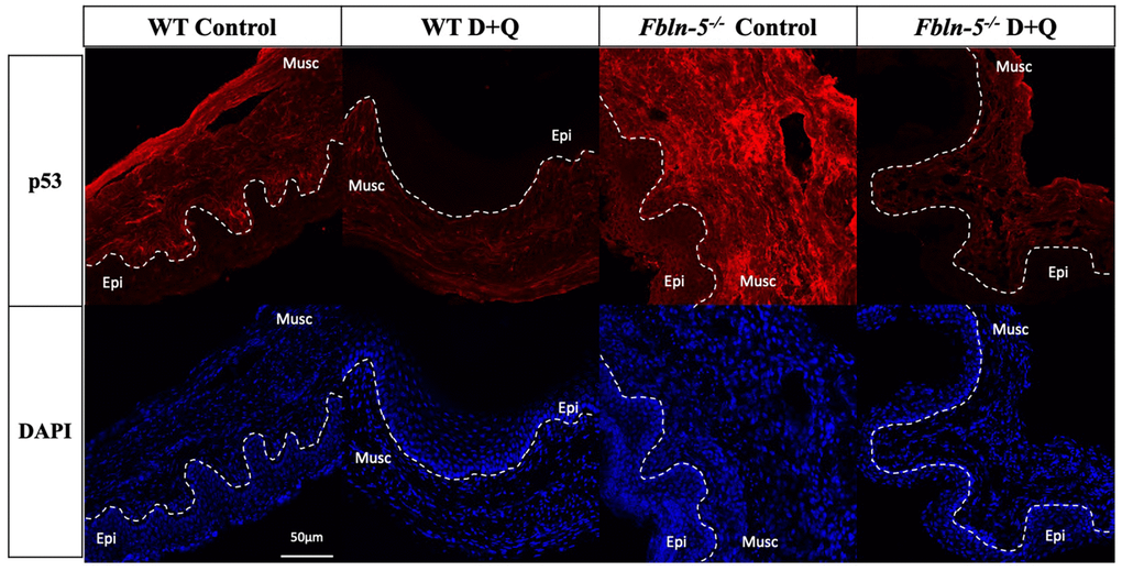 Impact of serial dasatinib and quercetin (D+Q) injections on p53 expression in the vaginal tissue of wild type (WT) and Fibulin-5 knockout (Fbln-5-/-) mice at 20 weeks of life. Representative tissue sections from WT control, WT treatment, Fbln-5-/- control and Fbln-5-/- treatment mice. Top panels demonstrate differences in p53 expression between groups. Bottom panels display corresponding DAPI staining to label cellular nuclei for anatomical reference. Epi=epithelium, Musc=muscularis. 20x magnification.