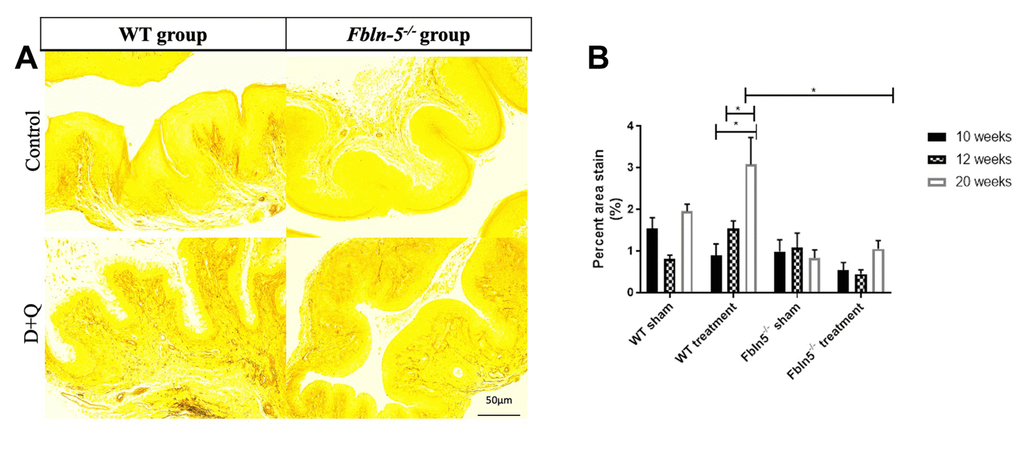 Impact of serial dasatinib and quercetin (D+Q) injections on elastin content in the vaginal tissue of wild type (WT) and Fibulin-5 knockout (Fbln-5-/-) mice at 20 weeks of life. Representative tissue sections from 20-week-old WT and Fbln-5-/- mice (A). Top panels correspond to WT and Fbln-5-/- mice in the control group and the bottom panels correspond to WT and Fbln-5-/- mice in the D+Q group. Quantification of vaginal tissue elastin content at 10, 12 and 20 weeks of life in WT control, WT treatment, Fbln-5-/- control and Fbln-5-/- treatment groups (B). Results are expressed as raw mean percent of total tissue ± SEM. 20x magnification.