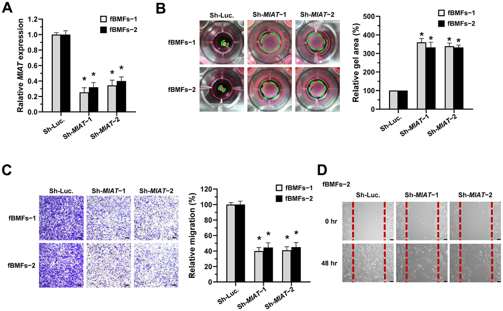 Knockdown of MIAT suppresses the myofibroblastic properties. (A–D) Primary fBMFs (obtained from two patients with OSF; fBMFs−1 and −2) were transfected with lentiviruses expressing non-targeting ShRNA (Sh-Luc.) and Sh-MIAT (Sh-MIAT−1 and −2). The MIAT knockdown efficiency was assessed using qRT-PCR analysis (A). The cells (fBMFs−1 and −2) were then cultured in collagen gel for additional 48 hours, and the gel area after cell contraction was measured (B). Cells (fBMFs−1 and −2) were cultured in Transwell system for an additional 24 hours, and their migration ability was quantified (C). Data are presented as mean ± SD (n=3); *p A–C). Confluent monolayers of fBMFs−2 were scratched and cultured for 48 hours, and the wound closure was assessed. Scale bar, 50 μm (D).