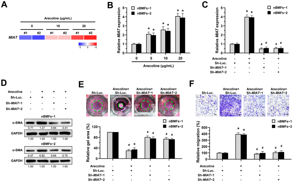 Knockdown of MIAT impairs the arecoline-induced myofibroblastic transformation in BMFs. (A) Primary nBMFs (obtained from two healthy individuals; nBMFs−1 and −2) were cultured with arecoline (0, 10, and 20 μg/mL) for 24 hours, followed by RNA-sequencing analysis to determine the levels of MIAT (p B) Normal BMFs (−1 and −2) were cultured with arecoline (0, 5, 10, and 20 μg/mL) for 24 hours, followed by qRT-PCR analysis to determine the MIAT expression. (C–F) Normal BMFs (−1 and −2) were transfected with lentiviruses expressing non-targeting ShRNA (Sh-Luc.) and Sh-MIAT (Sh-MIAT−1 and −2). After 48 hours, the cells were cultured with or without arecoline (20 μg/mL) for 24 hours for the induction of myofibroblasts transdifferentiation. The expression of MIAT in each group was assessed using qRT-PCR analysis. Data are presented as mean ± SD (n=3); *p p C). The protein expression of α-SMA in each group was determined using Western blotting analysis (D). Cells (nBMFs−1 and −2) were cultured in collagen gel for an additional 48 hours, and the resulting gel area after cell contraction was measured (E). Cells (nBMFs−1 and −2) were cultured in Transwell system for an additional 24 hours, and their migration ability was quantified (F). Data are presented as mean ± SD (n=3); *p p E, F).