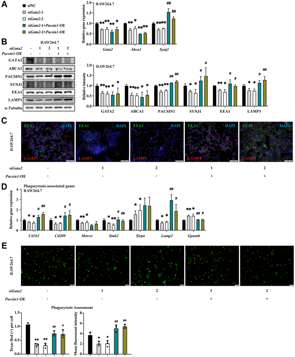 PACSIN1 mediates the effects of GATA2 downregulation on macrophage by regulating phagolysosome formation. RAW264.7 cells were co-transfected with or without siGata2 and Pacsin1 overexpression plasmids for 48 h. mRNA levels of Gata2, Pacsin1 and Synj1 were assessed by qPCR (A) and protein levels of GATA2, ABCA1, PACSIN1, SYNJ1, EEA1, and LAMP1 were assessed by western blotting (B) and immunofluorescence staining (C) in RAW264.7 cells from each group. mRNA levels of Cd163, Cd209, Marco, Stab2, Sirpa, Lamp2 and Gpnmb were measured by qPCR (D) in RAW264.7 cells from each group (siNC, black bars; siGata2-1, gray bars; siGata2-2, white bars; siGata2-1+Pacsin1-OE, teal bars; siGata2-1+Pacsin1-OE, asparagus bars). Phagocytosis assessment was done by Cell Meter™ Fluorimetric Phagocytosis Assay Kit (E). Scale bars = 50 μm. *P **P #P ##P Gata2.