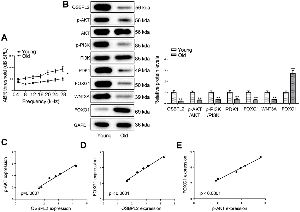 OSBPL2 downregulation and inactivation of AKT/FOXG1 signaling pathways in the cochleae of aged C57BL/6 mice. (A) ABR thresholds of C57BL/6 mice from Young (n=6) and Old (n=6) groups in response to tone pips of 8, 12, 16, 20, 24, 28, and 32 kHz. (B) Western blotting for expression levels of OSBPL2 and proteins related to AKT and FOXG1 signaling pathways in the cochleae of young and old C57BL/6 mice. (C, D) Association between OSBPL2 and p-AKT or FOXG1 expression in the cochleae of aged C57BL/6 mice. (E) Association between p-AKT and FOXG1 expression in the cochleae of aged C57BL/6 mice. * P