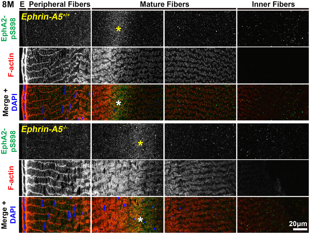 In lens fiber cells, EphA2-pS898 signal is localized to the cell membrane of mature fibers. Lens sections in the cross orientation from 8-month-old control and ephrin-A5-/- mice were stained with EphA2-pS898 (green) antibody, phalloidin (F-actin, red), and DAPI (nuclei, blue). EphA2-pS898 signal was present in mature fiber cells (asterisks). The signal appeared cytosolic and did not have obvious membrane localization. The staining signals were comparable between control and ephrin-A5-/- sections. Scale bar, 20 μm.