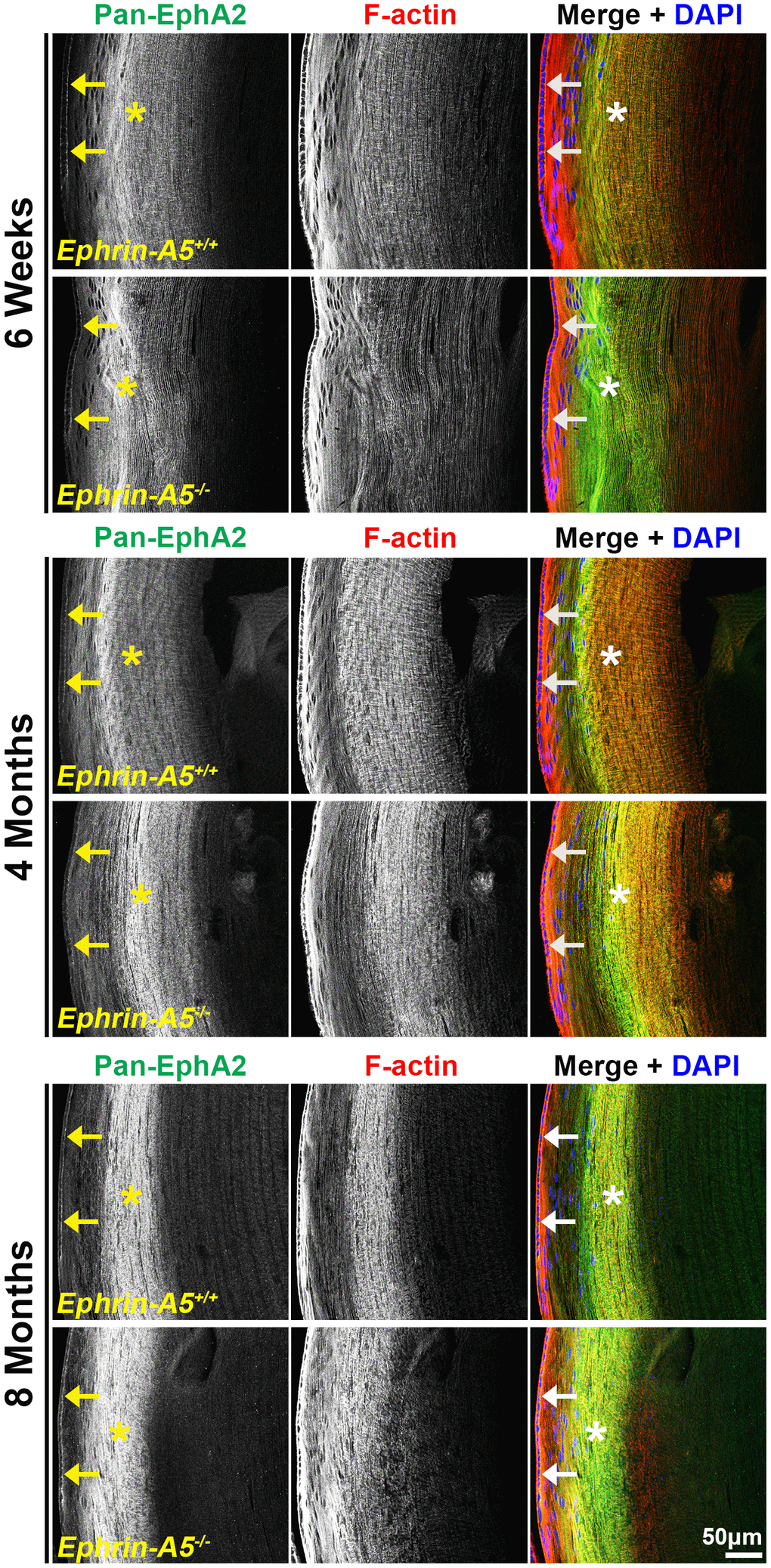 Pan-EphA2 is localized to epithelial and fiber cells with enriched signal in fiber cells. Longitudinal lens sections from 6-week-old, 4-month-old, and 8-month-old ephrin-A5+/+ and ephrin-A5-/- mice were stained with pan-EphA2 (green) antibody, phalloidin (F-actin, red), and DAPI (nuclei, blue). The pan-EphA2 signal was visible in epithelial cells (arrows) and was strongly localized within the cortical fiber cell region (asterisks). This pattern remained consistent between age-matched controls and ephrin-A5-/- lenses. Scale bar, 50 μm.