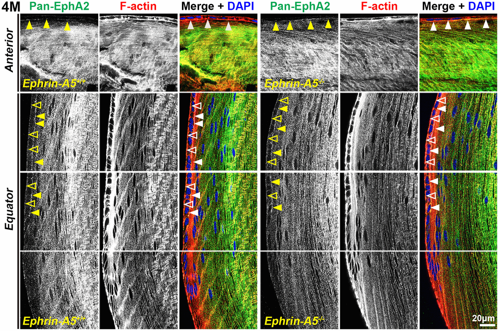 In lens cells, pan-EphA2 is localized to the cell membrane. Longitudinal lens sections from 4-month-old control and ephrin-A5-/- mice were stained with pan-EphA2 (green) antibody, phalloidin (F-actin, red), and DAPI (nuclei, blue). Images of the equator region were taken in sequence along similar areas of the lens. Fluorescence signal from pan-EphA2 appeared along the cell membrane within the lens. In anterior epithelial cells, there was increased pan-EphA2 signal at the apical-apical junction (arrowheads) between epithelial cells and fiber cells. In equatorial epithelial cells, pan-EphA2 was enriched at the basal (open arrowheads) membrane between epithelial cells and the lens capsule and at the apical membrane (arrowheads). In cortical lens fiber cells, pan-EphA2 outlined the cell membrane. There are no obvious differences between control and ephrin-A5-/- sections. Scale bars, 20 μm.