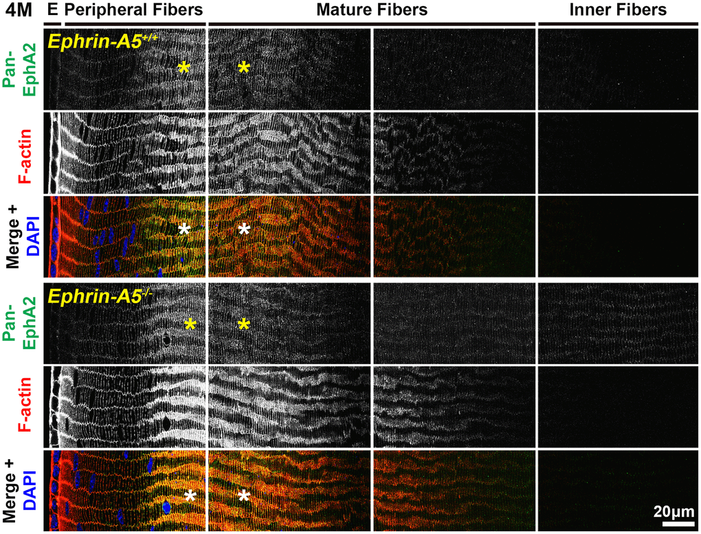 In lens fiber cells, pan-EphA2 is localized to the cell membrane and enriched along the short sides. Lens sections in the cross orientation from 4-month-old control and ephrin-A5-/- mice were stained with pan-EphA2 (green) antibody, phalloidin (F-actin, red), and DAPI (nuclei, blue). E denotes the epithelial cells, and images of the fiber cells were taken in sequence along similar areas of the lens equator. Fluorescence from pan-EphA2 was along the cell membrane of peripheral and mature fiber cells in the lens cortex region (asterisks). The signal was enriched along the short sides of lens fiber cells. Scale bar, 20 μm.