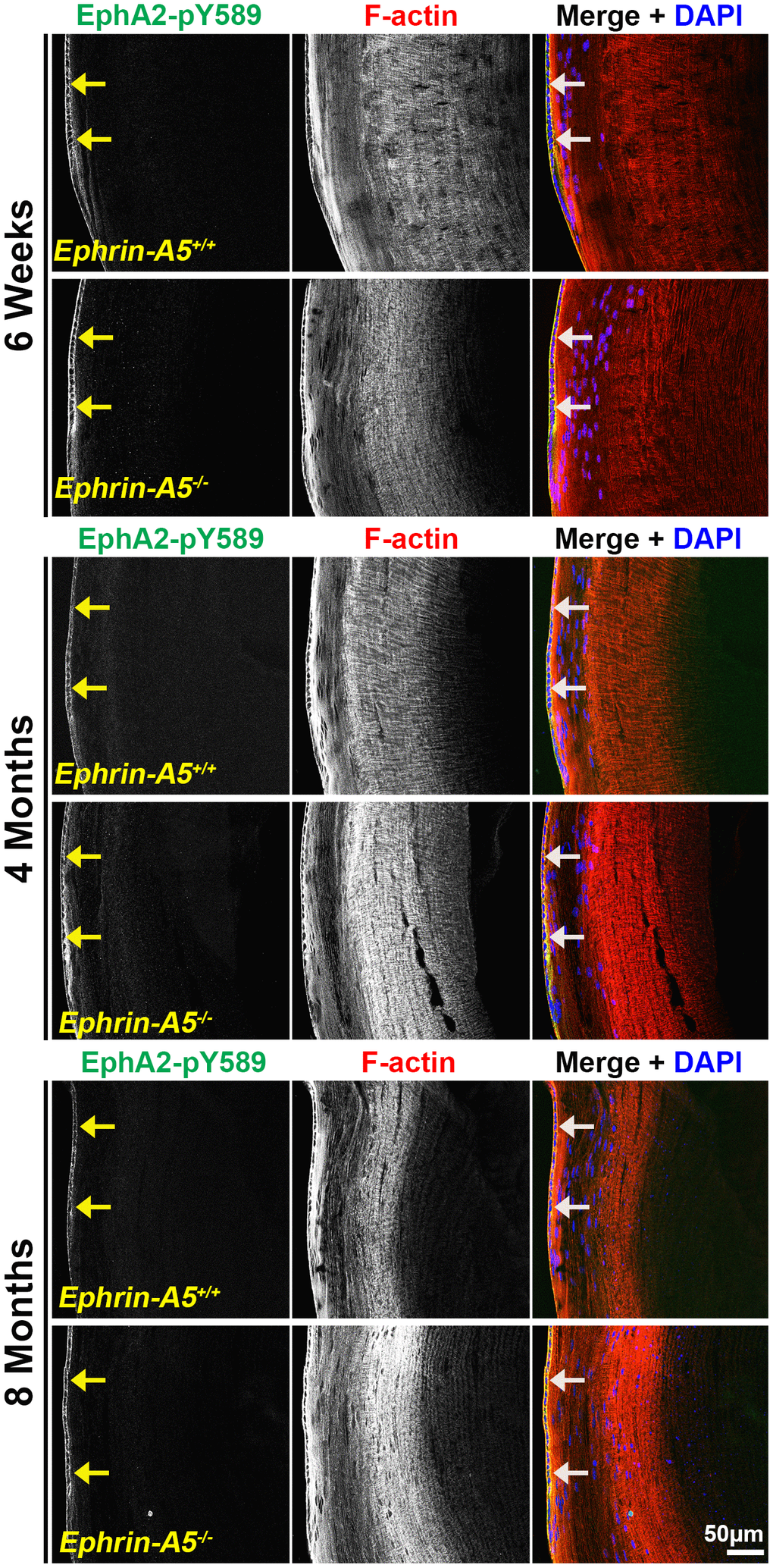 Canonically activated EphA2-pY589 protein is localized exclusively in epithelial cells. Longitudinal lens sections from 6-week-old, 4-month-old, and 8-month-old ephrin-A5+/+ and ephrin-A5-/- mice were stained with EphA2-pY589 (green) antibody, phalloidin (F-actin, red), and DAPI (nuclei, blue). The EphA2-pY589 fluorescence highlighted the lens epithelial cells (arrows) across all age-matched control and ephrin-A5-/- lenses. Scale bar, 50 μm.