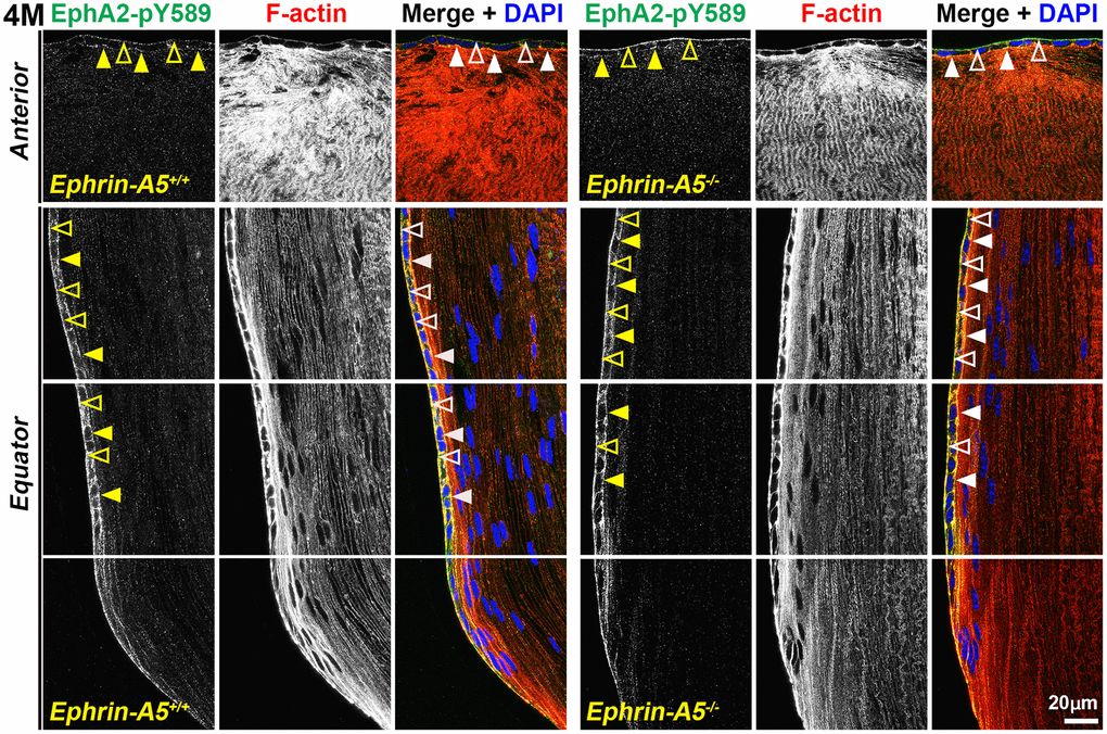 Canonically active EphA2-pY589 protein is enriched at basal and apical membranes of lens epithelial cells. Images of the equator region were taken in sequence along similar areas of the lens. In 4-month-old control and ephrin-A5-/- longitudinal lens sections stained with EphA2-pY589 (green) antibody, phalloidin (F-actin, red), and DAPI (nuclei, blue), the EphA2-pY589 signal was visible in anterior lens epithelial cells with enrichment at the basal (open arrowheads) and apical (arrowheads) membranes. There was increased EphA2-pY589 staining signal in equatorial epithelial cells with enrichment at the basal (open arrowheads) and apical (arrowheads) membranes. EphA2-pY589 staining was also visible between equatorial epithelial cells along the lateral membranes. There are no obvious differences in staining signal and localization between control and ephrin-A5-/- sections. Scale bar, 20 μm.