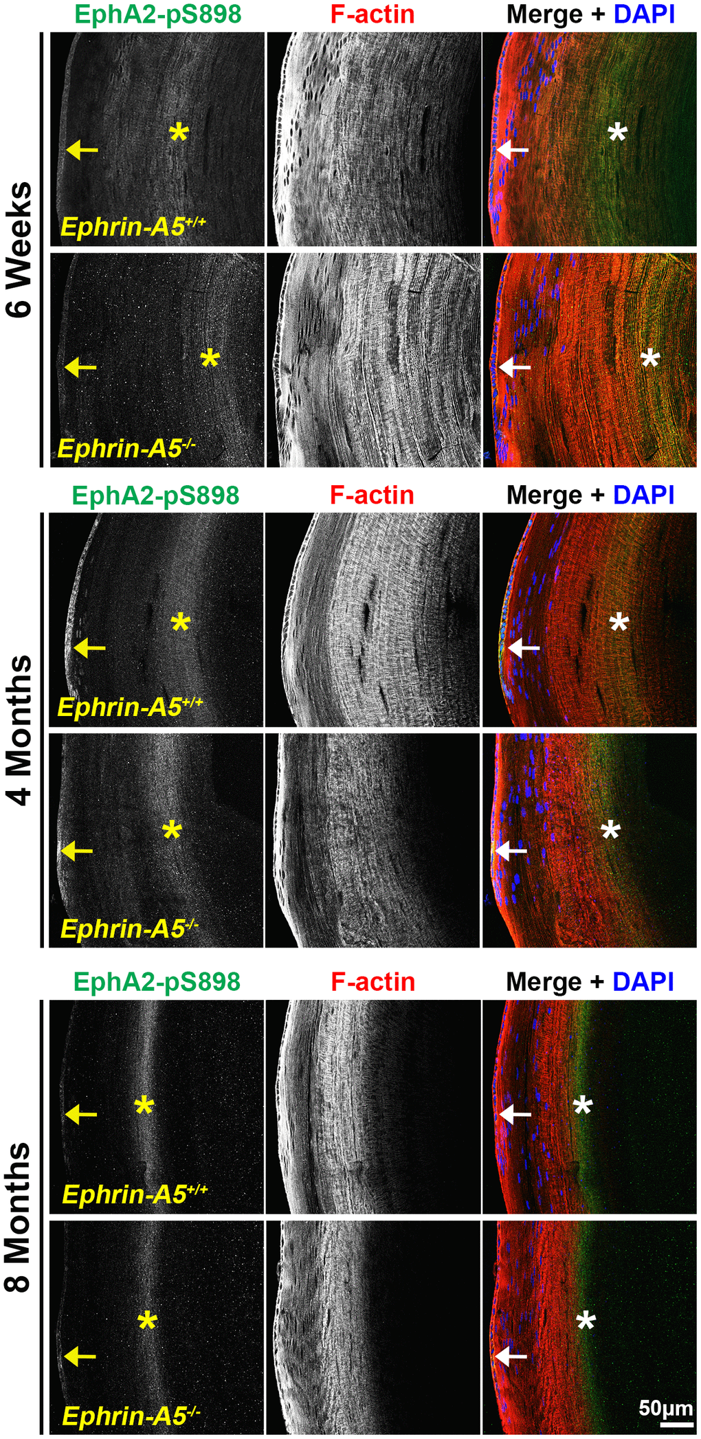 Non-canonically activated EphA2-pS898 protein is localized in epithelial cells and mature fiber cells. Longitudinal lens sections from 6-week-old, 4-month-old, and 8-month-old ephrin-A5+/+ and ephrin-A5-/- mice were stained with EphA2-pS898 (green) antibody, phalloidin (F-actin, red), and DAPI (nuclei, blue). Fluorescence of EphA2-pS898 was found within the epithelial cells (arrows) and as a band within mature fiber cells in the lens cortex (asterisks). The staining pattern remained consistent between age-matched control and ephrin-A5-/- lenses. There was a noticeable narrowing and intensification of the EphA2-pS898 band of signal in the cortical fiber cells region with age, which is likely due to compression of fiber cells as the lens continues to grow. Scale bar, 50 μm.