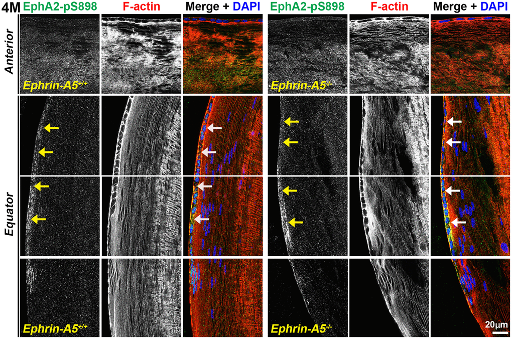 Non-canonically active EphA2-pS898 protein is enriched in equatorial lens epithelial cells. Longitudinal lens sections from 4-month-old control and ephrin-A5-/- mice were stained with EphA2-pS898 (green) antibody, phalloidin (F-actin, red), and DAPI (nuclei, blue). Images of the equator region were taken in sequence along similar areas of the lens. Mature fiber cells with strong EphA2-pS898 cannot be seen in these images of the peripheral fibers. EphA2-pS898 signal was found to weakly stain anterior epithelial cells, and there was increased signal in equatorial epithelial cells (arrows). There are no obvious differences between control and ephrin-A5-/- lenses. Scale bar, 20 μm.