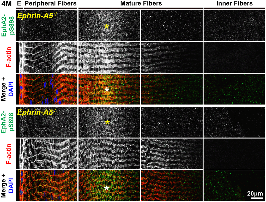 In lens fiber cells, EphA2-pS898 signal is localized to the cell membrane of mature fibers. Lens sections in the cross orientation from 4-month-old control and ephrin-A5-/- mice were stained with EphA2-pS898 (green) antibody, phalloidin (F-actin, red), and DAPI (nuclei, blue). E denotes the epithelial cells, and images of the fiber cells were taken in sequence along similar areas of the lens. EphA2-pS898 staining signals were enriched in mature lens fiber cells (asterisks), and these signals appear to be all around the cell membrane without preference between the broad and short sides of fibers. The staining signal was comparable between control and ephrin-A5-/- lenses. Scale bar, 20 μm.