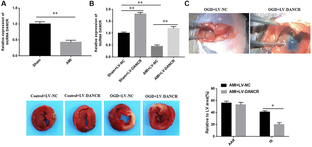 The expression of DANCR in AMI mice. (A) The expression of DANCR in myocardium of mice in the sham and AMI groups was detected with RT-qPCR. (B) Overexpression efficiency of DANCR was detected with RT-qPCR. (C) The infarct size (IS) and the areas at risk (AAR) of AMI mice were measured by using Evens blue and TTC staining. *P **P 