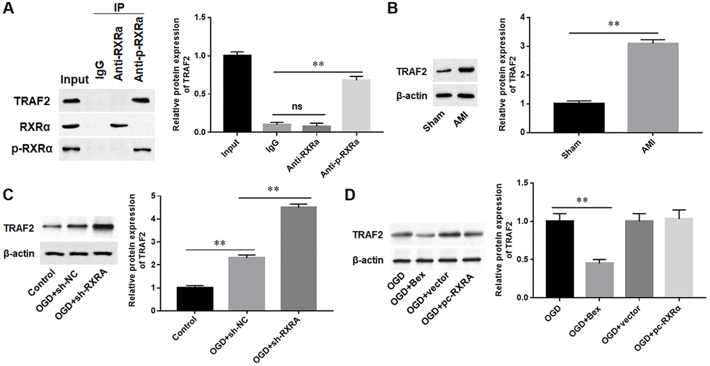 Phosphorylated RXRA interacted with TRAF2 to downregulate TRAF2 protein. (A) The interaction between RXRA and TRAF2 was detected by Co-IP analysis. (B) The protein expression of TRAF2 in mice of the sham and AMI groups was detected with Western blotting. (C) H9C2 cells were transfected with sh-RXRA or sh-NC, and then treated with OGD, and the protein expression of TRAF2 was detected with Western blotting. (D) H9C2 cells were transfected with RXRA overexpression vector (pc-RXRA) and control (vector), and then treated with OGD and/or Bex. The protein expression of TRAF2 was detected with Western blotting. **P 