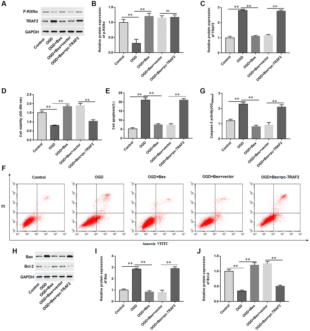 Overexpression of TRAF2 reversed the protective effect of Bex on cardiomyocytes. H9C2 cells were transfected with TRAF2 overexpression vector (pc-TRAF2) or control (vector), and then treated with OGD and/or Bex. (A–C) The protein expression of p-RXRA and TRAF2 was detected with Western blotting. (D) Cell viability was measured by using CCK-8. (E, F) Cell apoptosis was assessed by using Flow cytometry. (G) The activity of caspase-3 was assayed by ELISA. (H–J) Western blotting was used to detect the protein levels of Bcl-2 and Bax. *P **P 