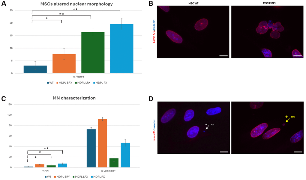 MSCs altered nuclear morphology analysis. (A) Histogram representing the percentage of aberrant nuclear morphology. (B) A representative image of MSCs WT and MDPL obtained by immunofluorescence for anti-Lamin A/C antibody (red). (C) Percentage of micronuclei (%MN) and percentage of Lamin B1 positive (% Lamin B1+) MN in MSCs MDPL and WT. (D) Representative immunofluorescence images showing the presence of micronuclei (MN) positive (arrow yellow) or negative (arrow white) for anti-Lamin B1 antibody (red) in MDPL cells. Hoechst nuclear staining (blue). Scale bar 100 µm. The WT data are derived from the mean of the values obtained from the two healthy control samples. Experiments were carried out in triplicates; 300 nuclei were counted per individual. Error bars indicate the standard deviation ± standard error of the mean (SEM). *p **p 