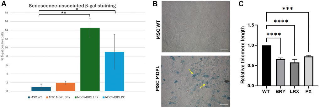 MDPL MSCs senescence and telomere shortening. (A) The histogram shows the average percentage of β-galactosidase-positive cells in WT and MDPL mesenchymal stem cells. (B) Representative image of senescence-associated β-galactosidase assay. A greater amount of intensely positive blue cells is displayed in MDPL-MSCs than in WT controls. Arrows indicated altered cell shape. Scale bar = 200 µm. Experiments were carried in triplicates; 100 nuclei were counted per individual. Error bars indicate the standard deviation ± standard error of the mean (SEM), *p **p C) Relative telomere length was evaluated by real-time q-PCR in MSCs MDPL and WT. Experiments were carried in triplicates. Error bars indicate the standard deviation ± standard error of the mean (SEM). ***p ****p 