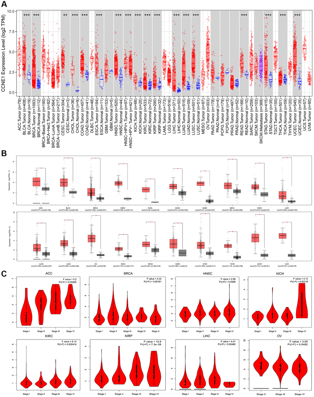 Expression of CCNE1 in different tumors and pathological stages. (A) The expression of CCNE1 in pan-cancer. The expression of CCNE1 in tumor tissue is indicated in red, while the expression of CCNE1 in normal tissue is shown in blue. (B) The expression status of CCNE1 in normal tissue and cancer tissue. The expression of CCNE1 in tumor tissue is indicated in red, while the expression of CCNE1 in normal tissue is shown in grey. (C) Correlation of CCNE1 with pathological stages in multiple cancers.