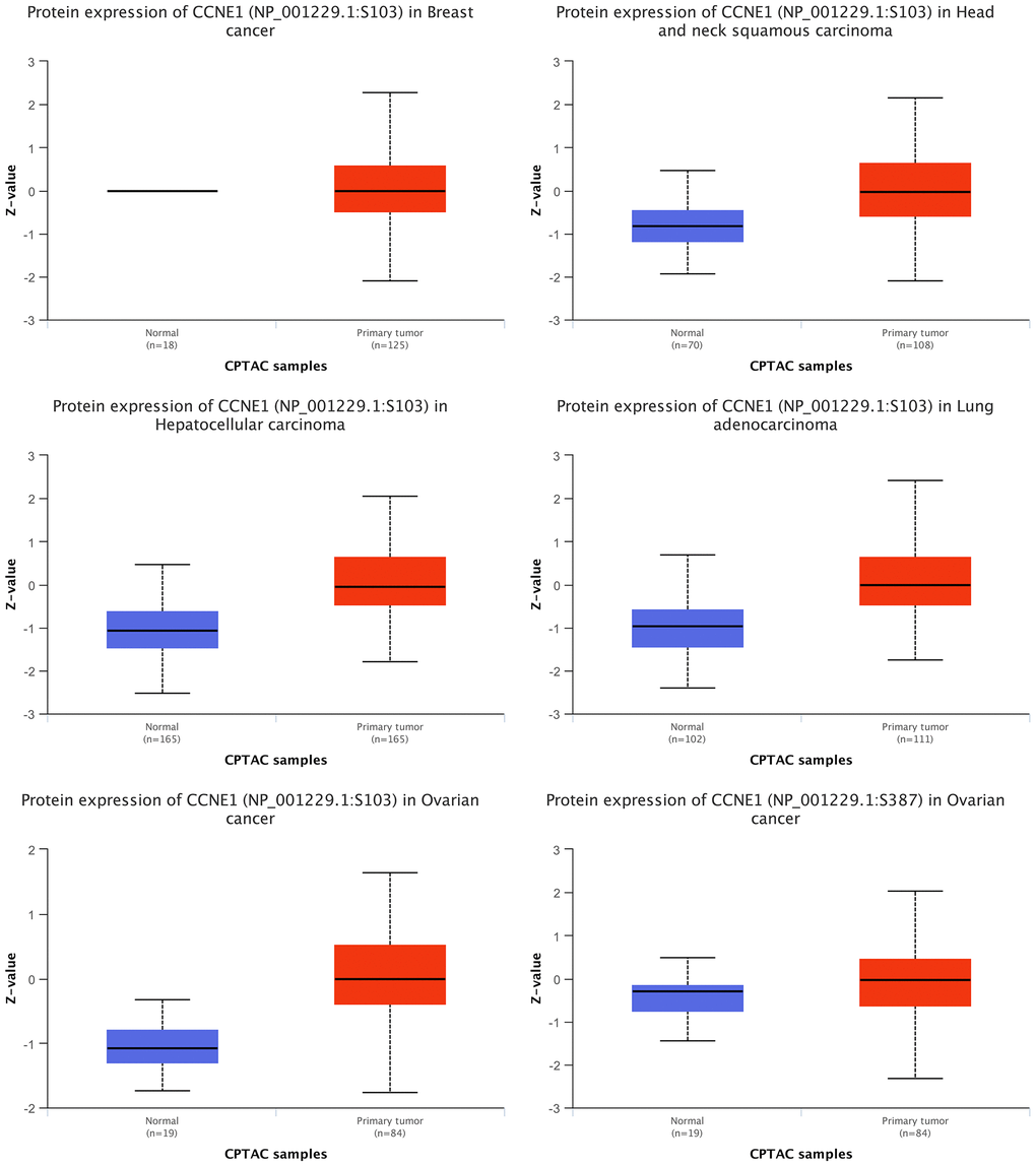Expression of CCNE1 protein in multiple cancers. The expression of CCNE1 in tumor tissue is indicated in red, while the expression of CCNE1 in normal tissue is shown in blue.
