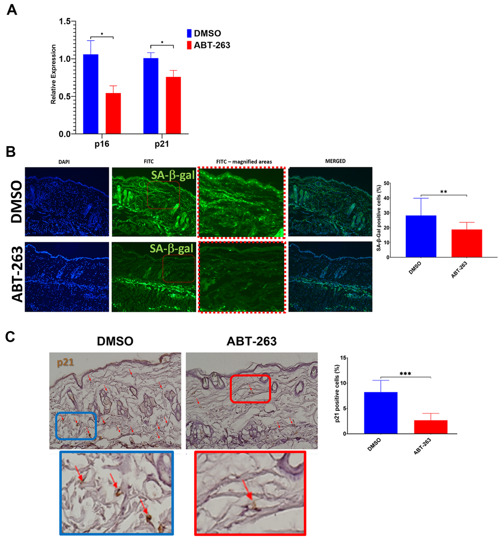 Decreased senescence markers in aged skin treated with topical ABT-263. (A) Relative p16 and p21 expression in whole skin after 5 days of ABT-263 (N=5) vs. DMSO treatment (N=5). (B) SA-β-gal positive cells (green) and quantification of percentage of positive cells. (C) p21 staining and quantification of percentage of positive cells. *p