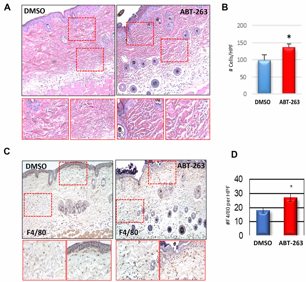 Increased dermal macrophage infiltration in aged skin treated with ABT-263. (A) H&E sections of aged skin after 5 days of ABT-263 (N=5) vs DMSO (N=5) treatment. (B) Number (#) of total cells/high-powered field (HPF). (C) F4/80 staining with areas of magnification in red displayed below, and (D) quantification of number (#) of F4/80+ cells per HPF. * indicates p