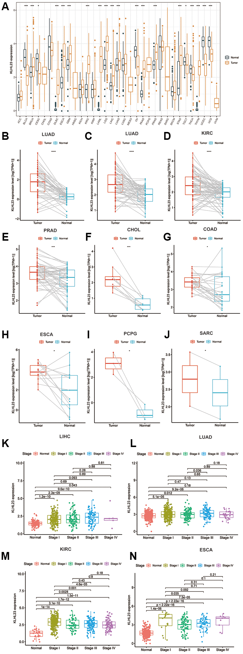 The differential expression of KLHL23 in human tumors and healthy tissues among the 33 types of cancer. (A) The black and yellow bar graphs indicate KLHL23 levels in normal and tumor tissue. (B–J) Pan-cancer differential expression of KLHL23 in paired tumor and adjacent normal tissue in the indicated, represents tumor types (liver hepatocellular carcinoma (LIHC), LUAD, KIRC, PRAD, CHOL, COAD, ESCA, PCPG, and SARC) from the TCGA database. (K–N) KLHL23 mRNA expression levels in diverse stages of the indicated tumor types from the TCGA database (LIHC, LUAD, KIRC, ESCA). Blue and red bars indicate normal and tumor tissue KLHL23 levels (*P **P ***P 