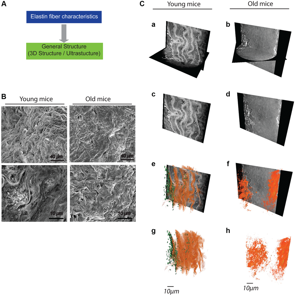 General impact of aging on the general structuring of elastic fibers within the aortas (n = 4/group). (A) Decision tree allowing the evaluation of the general organization of elastic fibers. (B) Low (top panels) and high (bottom panels) magnification images obtained from scanning electron microscopy. (C) Images obtained by high-resolution X-ray microscopy (panels a–f). A 3D reconstruction of the network of elastic fibers (red) and cells (green) is made from the images (panels e–h).