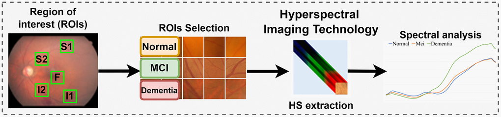 Experimental flow chart. Hyperspectral imaging technology was utilized to extract spectral features from five designated positions, known as Regions of Interest (ROIs), within the augmented dataset. This dataset was developed through a manual process based on the MMSE. Spectral analysis was then applied to these ROIs. The diagram highlights the cropped region of the fundus image as the Region of Interest (ROI), with the sampling positions located above the temporal vascular arcade (S1 and S2), at the fovea (F), and below the temporal vascular arcade (I1 and I2).