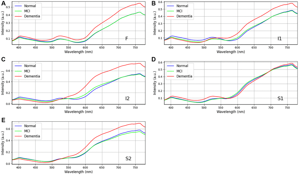 Retinal spectra of the same age women in different degrees of dementia among dementia group (n = 24), MCI group (n = 18), and Normal group (n = 16). (A–E) show the different region in the retina (A) F, (B) I1, (C) I2, (D) S1, and (E) S2. Specifically, positions F, I1, I2 and S2 show the difference in the long wavelength region (>550 nm). Data shown as mean normalized spectrum.