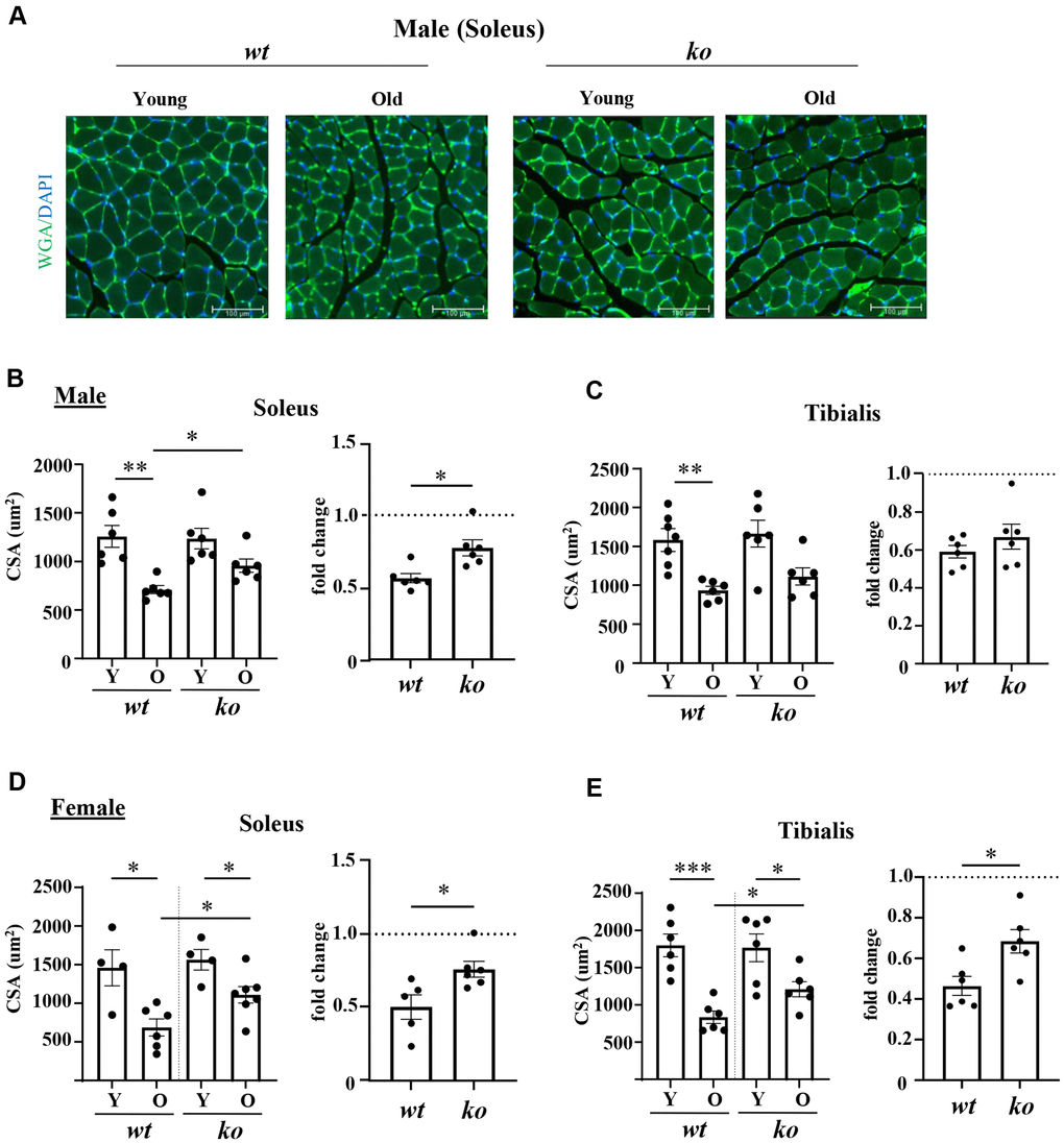 Arg-ii-/- mice reveal protection against age-associated sarcopenia (muscle fiber cross-sectional area, CSA). (A) Representative images of soleus sections stained for nuclei with DAPI (blue) and skeletal sarcolemma with WGA (green) in young and old wild type (wt) and arg-ii-/- (ko) male mice. Scale bar: 100 µm. (B–E) left panels present quantification of CSA in µm2 of soleus and tibialis, in male and female mice, while the right panels present the fold change in CSA based on the ratio of old/young reflecting the age-dependent reduction of CSA. Combined parametric one-way ANOVA and unpaired t-test with Welch’s correction were applied; n = 4–7 mice for each group. *p **p ***p 