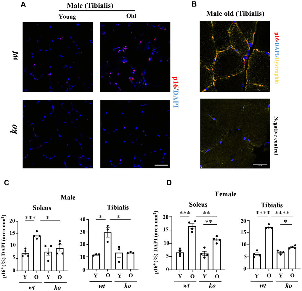 Arg-ii-/- mice reveal reduced senescent cells in aging skeletal muscles. (A) Representative confocal immunofluorescence staining of DAPI (blue) and anti-p16 (red) in tibialis from young and old wild type (wt) and arg-ii-/- (ko) male mice. Scale bar: 50 µm. (B) Representative image of old male mouse tibialis stained with DAPI (blue), anti-p16 (red), and anti-dystrophin (yellow, marker of sarcolemma). Negative control staining without the two primary antibodies. Scale bar: 20 µm. (C, D) Quantification of p16+ nuclei (senescent cells) expressed as the percentage of p16+ nuclei/total number of nuclei in the mm2 area. One-way ANOVA test was applied. n = 3–4 mice per group. *p **p ***p ****p 