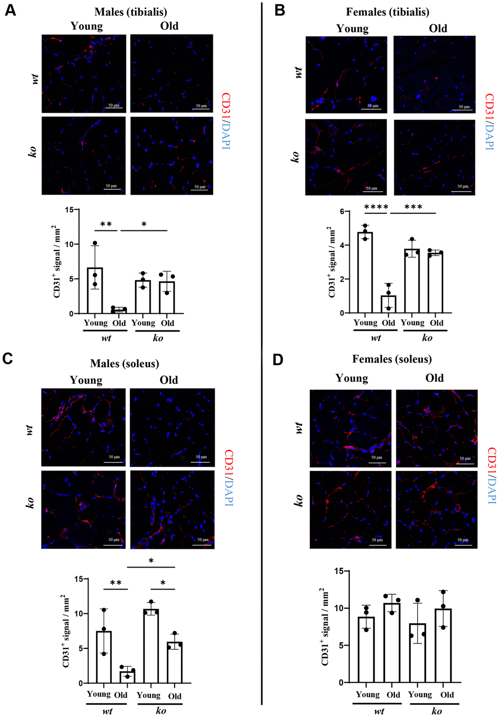 Arg-ii-/- mice reveal preserved microvascular density in aging skeletal muscle. (A) Representative confocal images showing CD31 staining (red; endothelial cells marker) in male tibialis of young and old male wild type (wt) and arg-ii-/- (ko) mice. DAPI (blue) is used to stain the nuclei. The graph reports the quantification of CD31 signal in the area (mm2). Scale bar: 50 µm. (B to D) Representative confocal images and relative quantification for CD31 (red) and DAPI (blue) in tibialis from young and old female wt and ko mice (B), and in soleus of young and old male (C) and female (D) wt and ko mice. Scale bar: 50 µm. One-way ANOVA was applied with n = 3 mice per group. *p **p ***p ****p 