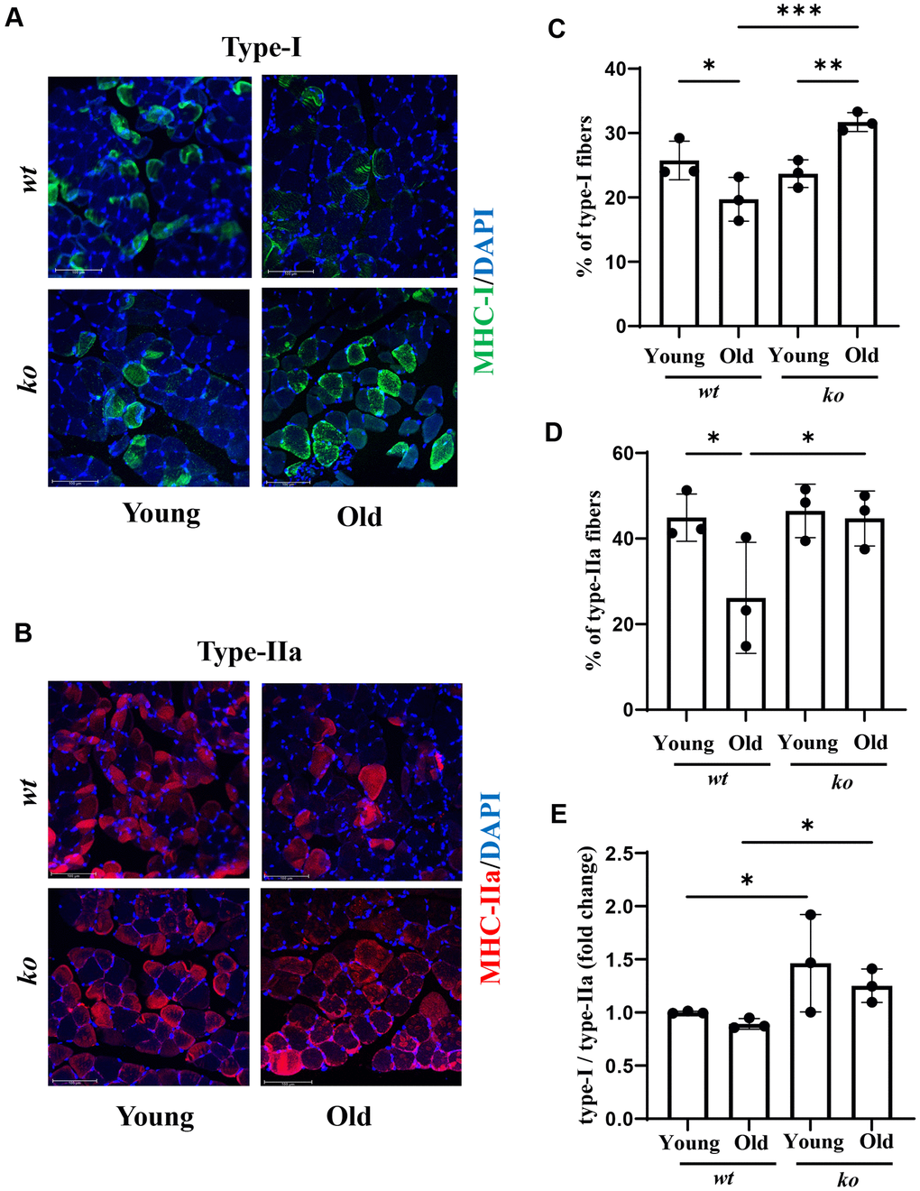 Arg-ii deficiency prevents age-associated decrease in type-I and type-II muscle fibers. Representative confocal images showing Type-I (A) and Type-IIA (B) fibers in the soleus of young and old wt and arg-ii-/- (ko) male mice. DAPI (blue) is used to stain nuclei. Scale bar = 100 µm. The graphs present the percentage of Type-I (C) and Type-II (D) fibers over the total number of fibers in the image. (E) the graph shows the ratio of Type-I and Type-II fibers expressed as fold change (wt young group was taken as reference). One-way ANOVA test was applied. n = 3 mice per group. *p **p ***p 