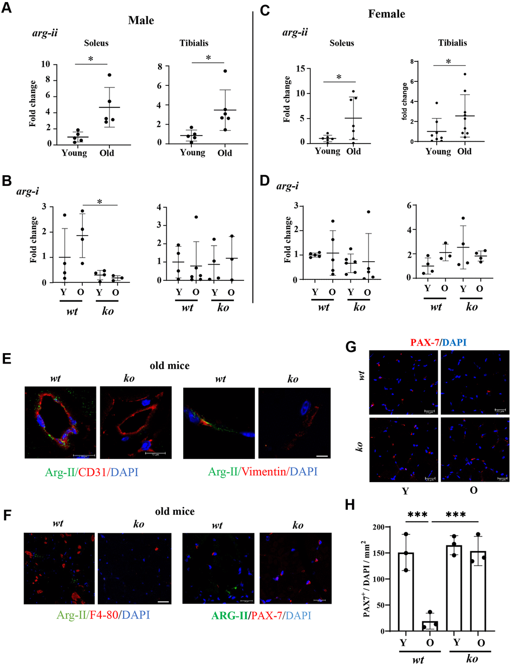 Arg-ii expression and cellular localization in aging skeletal muscles. Arg-ii mRNA levels were analyzed by qRT-PCR in skeletal muscles of wild-type (wt) male (A) and female (C) mice. (B, D) arg-i expression in soleus and tibialis from young and old wt and ko mice in both sexes. A parametric unpaired t-test with Welch’s correction was applied. n = 3–9 mice per group. *p E) Representative confocal images of old wt and ko skeletal muscle showing co-localization of Arg-II (green) with CD31 (red, endothelial marker), and with Vimentin (red, fibroblasts marker). (F) Representative confocal images of old wt and ko muscle showing lack of co-localization of Arg-II (green) with F4-80 (red, macrophage marker), and with PAX-7 (red, satellite cells marker). DAPI (blue) stains cell nuclei. Scale bar: 10 µm (Arg-II/CD31); 25 µm (Arg-II/Vimentin); 10 µm (Arg-II/F4/80); 20 µm (Arg-II/PAX-7). Each experiment was repeated with 3 animals. (G) Representative confocal images of PAX-7 (red) in skeletal muscle of young and old wt and arg-ii-/- mice. Scale bar: 25 µm. (H) Quantification of PAX-7+ cells (satellite cells) in skeletal muscle expressed as the percentage of PAX-7+/total number of cells in the mm2 area. One-way ANOVA test was applied. n = 3 mice per group. ***p 