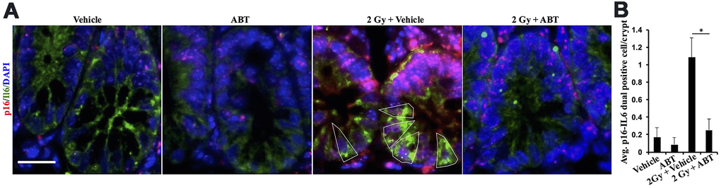 ABT-263 eliminates SASP cells from the intestinal epithelium of γ-exposed Apc1638N/+ mice. (A) Representative immunofluorescence micrographs of the intestinal epithelium showing p16 (red) and IL6 (green) dual-positive cells. (B) Quantification of p16 and IL6 dual-positive cells. Data presented as mean ± SEM, and * p