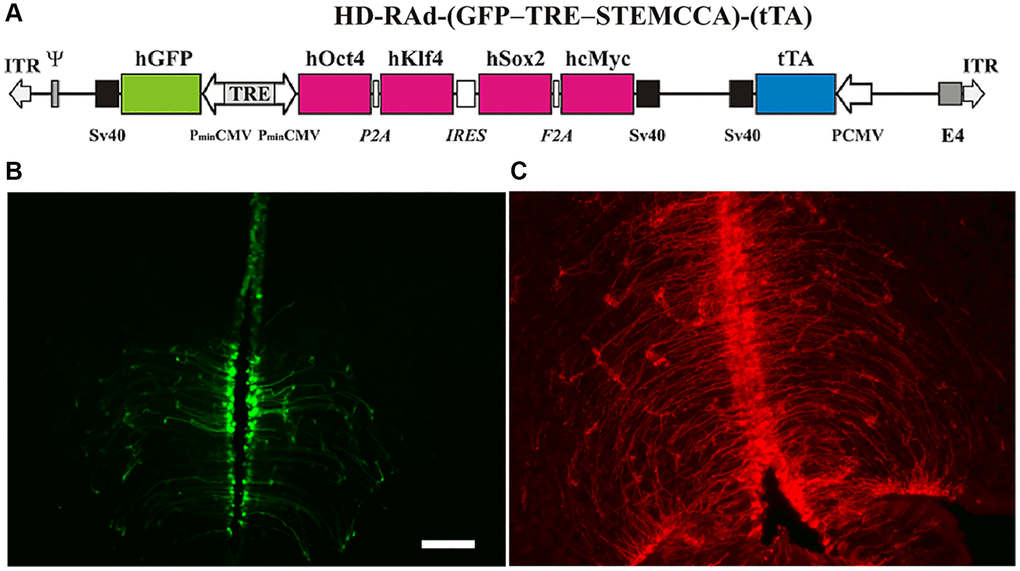 (A) The figure illustrates the basic components of HD-RAd-STEMCCA-GFP-Tet-Off genome. Abbreviations: GFP: humanized Green Fluorescent Protein; TRE: Tetracycline responsive element; tTA: chimeric regulatory protein; PminCMV: cytomegalovirus minimal promoter; SV40pA: polyadenylation signal; ITR: inverted terminal repeats; ψ: packaging signal. (B) Expression of GFP from the adenovector HD-RAd-STEMCCA-GFP in the third ventricle of the rat hypothalamus 6 days after vector injection in the lateral ventricles. Notice the processes of the ependymal tanycytes forming an extensive network in the hypothalamic parenchyma. Scale bar, 50 µm (for both, B, C). (C) Expression of DsRed2 from the control adenovector HD-RAd-DsRed2 in the rat hypothalamus 30 days after vector injection. Notice the processes of the ependymal tanycytes forming an extensive network in the hypothalamic parenchyma.