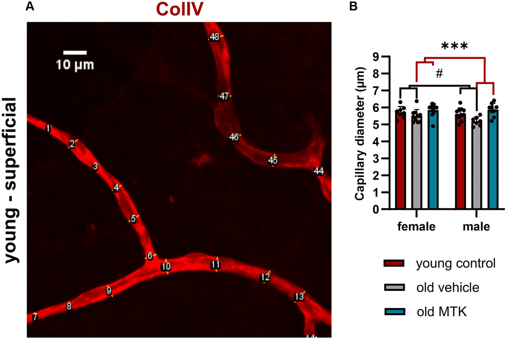 Capillary diameter in superficial retinal layers of young untreated, vehicle-treated and MTK-treated old mice. The capillary diameter was measured using ImageJ. (A) Representative image showing how the capillary diameter was measured. (B) Capillary diameter in the superficial retinal layers of young untreated, vehicle-treated and MTK-treated old mice. The values are represented as bar graphs and scatter plots ± SDs, n = 7–11. Two-way ANOVA (main factors: group and sex) followed by a Dunnett multiple comparison test. #p ***p 