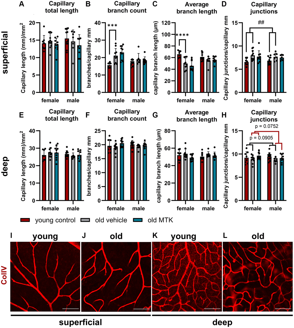 Capillary analysis of the superficial and deep retinal layers of young untreated, vehicle-treated and MTK-treated old mice. (A) Capillary total length, (B) branch count, (C) average branch length and (D) junctions in superficial retinal layers. (E) Capillary total length, (F) branch count, (G) average branch length and (H) junctions in deep retinal layers. Representative images of ColIV (red)-positive capillary structures in (I) young untreated and (J) old vehicle-treated superficial retinal layers and (K) young untreated and (L) old vehicle-treated deep retinal layers. Scale bar = 100 µm. The data are represented as bar graphs and scatter plots ± SDs, n = 7–11. Two-way ANOVA (main factors: group and sex) followed by a Dunnett multiple comparison test. ##p ****p ***p 