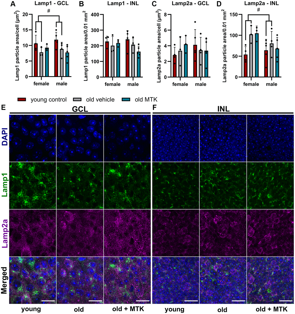 Labeling of Lamp1 and Lamp2a in the retinal GCL and INL of young untreated, vehicle-treated and MTK-treated old mice. Positive labeling was analyzed using ImageJ. Lamp1 particle area in the (A) GCL (area per cell) and (B) INL (per 0.01 mm2). Lamp2a particle area in the (C) GCL (area per cell) and (D) INL (0.01 mm2). Representative images of Lamp1 (green) and Lamp2a (magenta) labeling in the (E) GCL and (F) INL of young untreated, vehicle-treated and MTK-treated old mice. Scale bar images = 20 µm. The data are represented as bar graphs and scatter plots ± SDs, n = 3–5. Two-way ANOVA (main factors: group and sex) followed by a Dunnett multiple comparison test. #p 