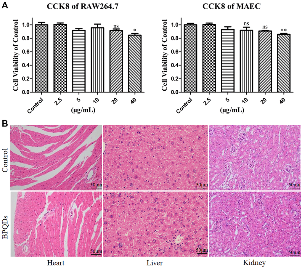 (A) Viabilities of RAW264.7 macrophages and MAECs after treatment with gradient concentrations of BPQDs. (B) Pathological sections of the heart, liver and kidney.