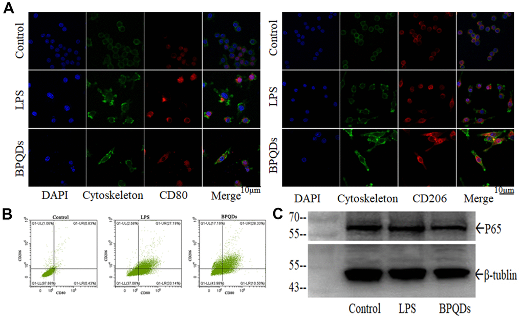 (A) Fluorescence intensity of CD80 and CD206 in macrophages observed by confocal. (B) Flow cytometry of macrophages expressing CD80 and CD206. (C) Western blot of P65.