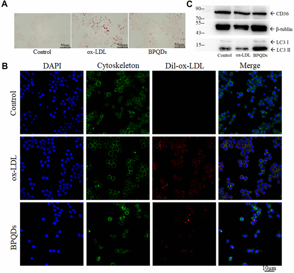 (A) Oil red O staining of macrophages/foam cells. (B) Fluorescence intensity of ox-LDL observed by confocal. (C) Western blot of CD36 and LC3 II / I.