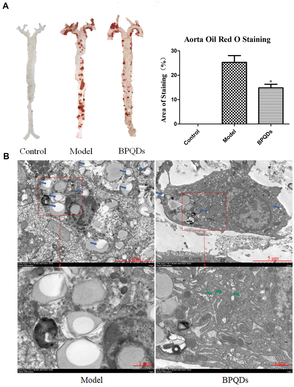 (A) Comparison and quantification of oil red O staining photos of aorta of mice after BPQDs treatment. (B) Comparison of electron microscopic photographs of aorta of mice treated with BPQDs. (Blue arrow: lipid droplet, green arrow: autophagosome).