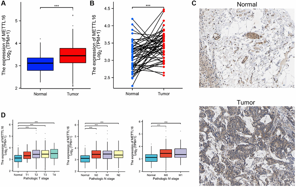 METTL16 is upregulated in CRC. (A, B) METTL16 expression in the TCGA CRC cohort. (C) Representative images of METTL16 IHC staining in CRC tissues and adjacent tissues. (D) Association of METTL16 mRNA expression with clinical stage grade.