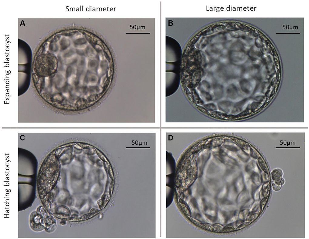 Representative microscopic photographs of the two different types of analyzed blastocysts. (A) Shows an exemplary photograph of a large expanding blastocyst (group Bl. 4; ≤185 µm). (B) Shows an exemplary photograph of a large expanding blastocyst (group Bl. 4; >185 µm). (C) Shows a small hatching blastocyst (group Bl. 5; ≤195 µm). (D) Shows a large hatching blastocyst (group Bl. 5; >195 µm).